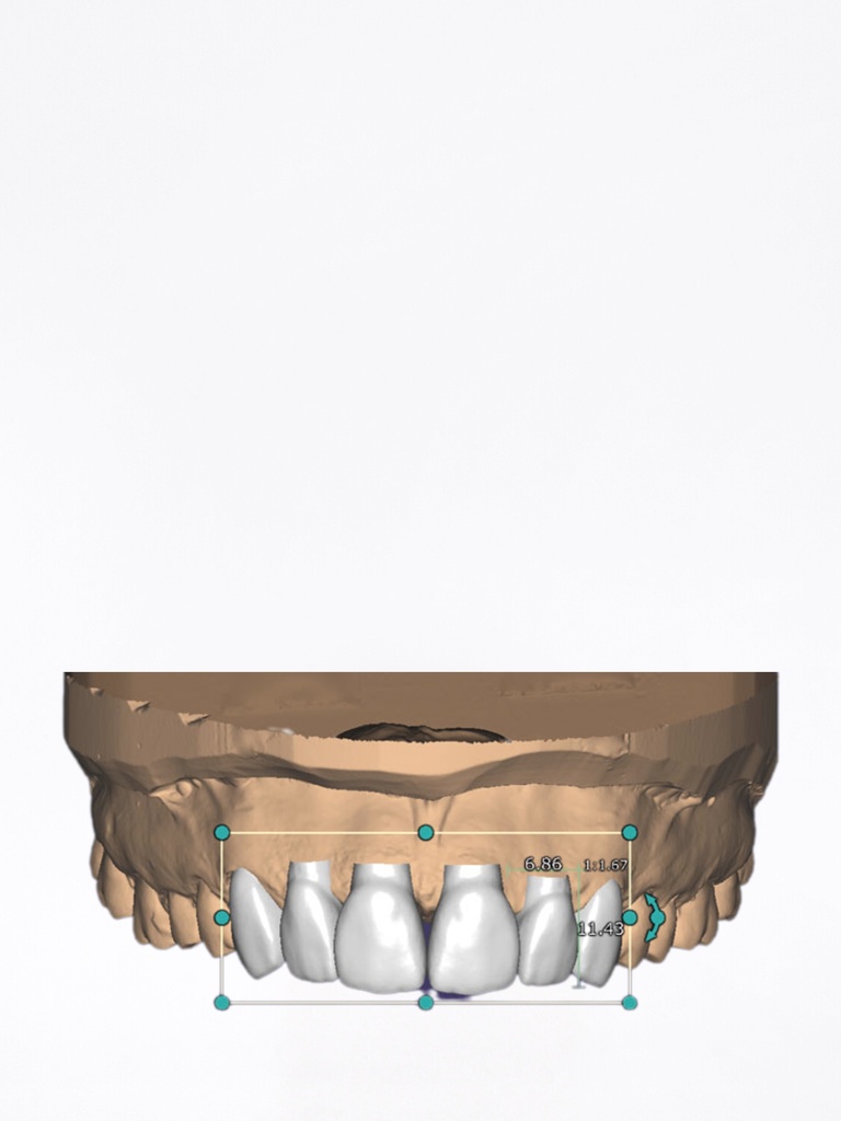 ChairsideCAD - Modulo Smile Creator incl. TruSmile Stand Alone
